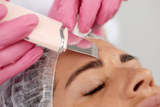Want a Flawless Complexion? Find Out How Our Frisco Chemical Peel Erases Hyperpigmentation!